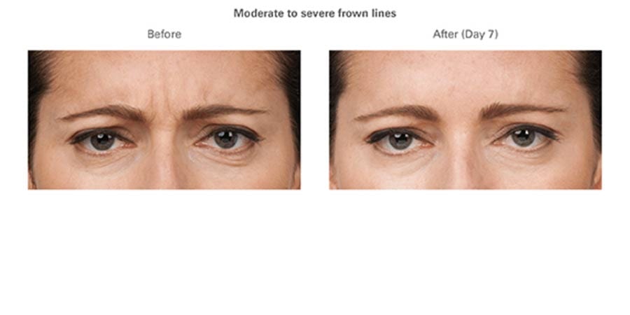 dr-haena-kim-ba-walnut-creek-04-900x450